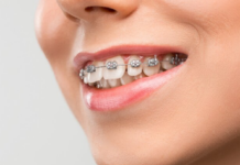 Smile Enhancement at the Best Dental Clinic in Trivandrum