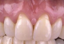 Specialty Dental Clinic in Trivandrum for Advanced & Compassionate Dental Care