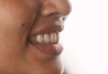 Smile Design in Kochi: A Simple Guide to a Confident Smile